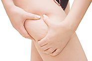 What Is Cellulite And What Are The Most Effective Ways To Treat It