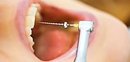 Dental Implants - A Complete Solution To Your Teeth!