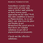Pigmentation Removal | Pigmentation Treatment