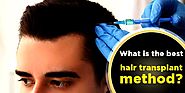 Which hair transplant method is the best? Why?