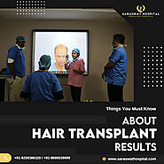 What are the Things You Must Know about Hair Transplant Results?