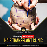 How to Choose the Best Hair Transplant Clinic in India?