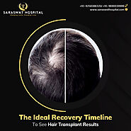What is the Ideal Recovery Timeline to see Hair Transplant Results in India?