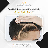 How Can Hair Transplant Repair in India Help Cover Strip Scars?