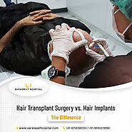 What are the Differences between Hair Implants & Hair Transplant Surgery?