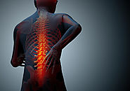 SGA Blogs - A Platform to Find Information in all Categories: Vertebral Fracture Symptoms and Treatment