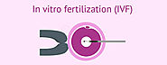 In Virto Fertilization Treatment in Hyderabad