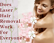 Does Laser Hair Removal Work for Everyone? | Laser Hair Reduction