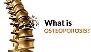 What is Osteoporosis? Risk factors, diagnosis, and treatment