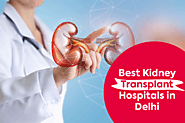 Best Kidney Transplant Hospitals in Delhi