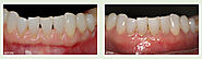 Holistic Restorative Dentistry from the Dentist South Miami Trusts