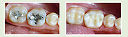 Coral Gables Dentist | Hank Barreto DMD | Dental Aesthetics