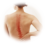 Scoliosis treatnent in Yakima Acute Chiropractic Yakima