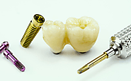 The Reasons for the Rising Popularity of Dental Implants