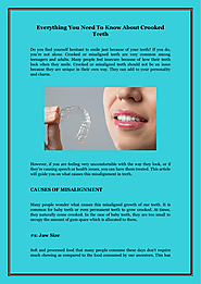 Everything You Need To Know About Crooked Teeth