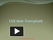 Best FUE Hair Transplant in Pune by Sai Cosmetics