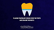5. Placing temporary crown over the tooth and sealing the roots