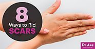 8 Secrets on How to Get Rid of Scars - Dr. Axe