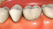 4 Dental Care Tips You Must Not Disregard — Write.as