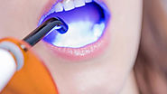 Proper Dental Care Tips For People — Write.as