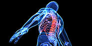 Entender Sobre Los Implantes Espinales
