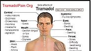Tramadol Side Effects