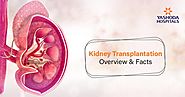 Frequently asked questions about kidney transplant