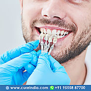 Affordable All on Four Dental Implants in India || CureIndia