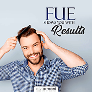 FUE Shows You with Results