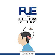 FUE Your Hair Loss Solution