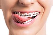 “متخصص ارتودنسی” فردی است که چینشی زیبا برای دندان‌های یک فرد ایجاد می‌کند.