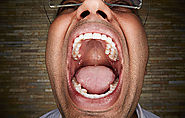 Man with Most teeth in World is from India - Amazopedia