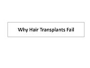 Why Hair Transplants Fail