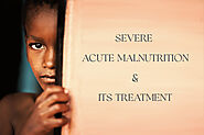 Severe Acute malnutrition
