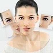 Thread lift in toronto and mississauga - Silhouette Soft Facelift | Lip Doctor