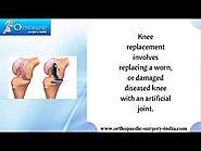 Knee Joint Replacement in Ernakulam | Knee Joint Surgery for Knee Replacement In Kerala, India