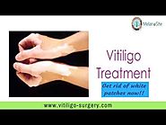 Vitiligo Surgery in New Delhi | Skin Discoloration Treatment | Vitiligo Skin Disease Treatment India