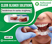 Perfect Smile with Invisible Aligners