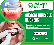 Transform Your Smile with Invisible Aligners