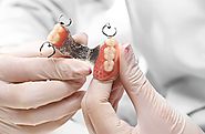 Who can take the benefit of the Dentures Melbourne Specialist Treatment? - Holistic Dental Melbourne CBD