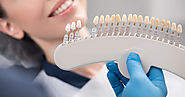 How to make it worth investing into dental crowns and bridges cost?