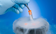 How Does Cryopreservation Affect the Sperm | IVF Davao, Inc.