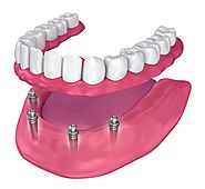 Website at https://www.bluetoothdentalclinic.co.in/fixed-prosthetic-dentures