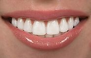 Website at https://www.bluetoothdentalclinic.co.in/cosmeticdentistry