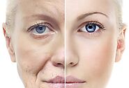 Prevent Yourself From Aging Before Your Time - E Who Know