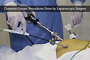 Laparoscopy Surgery | Dr Sheela Chhabra