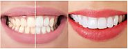 Two easy ways to keep the teeth strong and white. - Health And Fitness