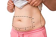 Tummy Tuck Treatment - Cosmetic Surgery