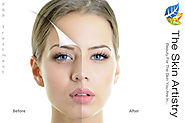 Skin Artistry- Ultimate Destination for PRP Treatment in Ahmedabad