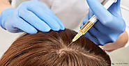 Hair Transplants: The Leading Method Of Hair Restoration
